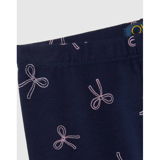 Product OVS LEG AOP 4-5 COL W/GLITTER base image